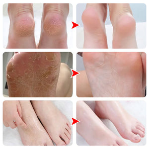 Chaussettes En Silicone Hydratante Pour Des Pieds Lisses Et Délicats