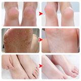 Chaussettes En Silicone Hydratante Pour Des Pieds Lisses Et Délicats